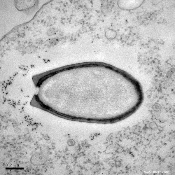 Virus surdimensionnés découverts 