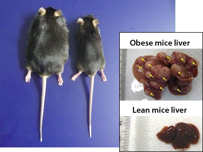 Les bactéries intestinales obèses favorisent le cancer du foie 