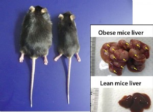 Les bactéries intestinales obèses favorisent le cancer du foie 