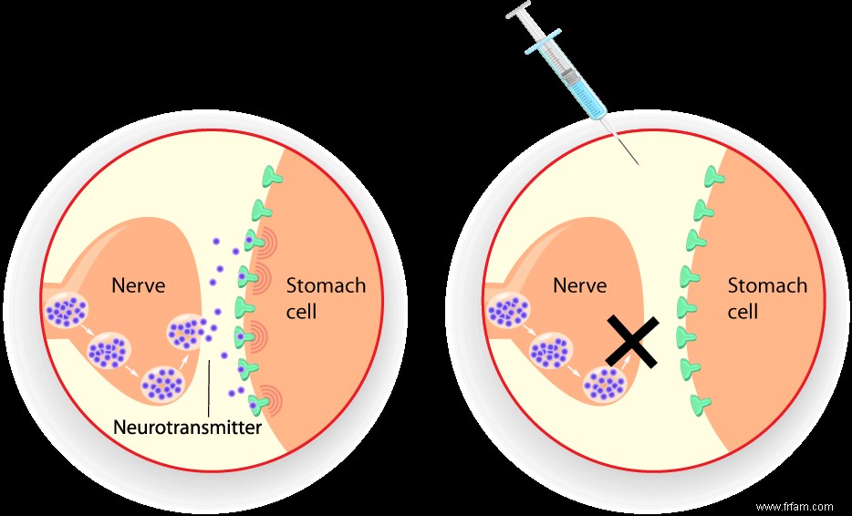 Botox contre le cancer 