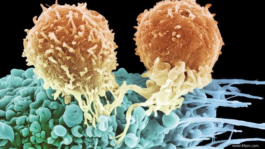 La thérapie par lymphocytes T gagne de plus en plus la bataille contre le cancer 