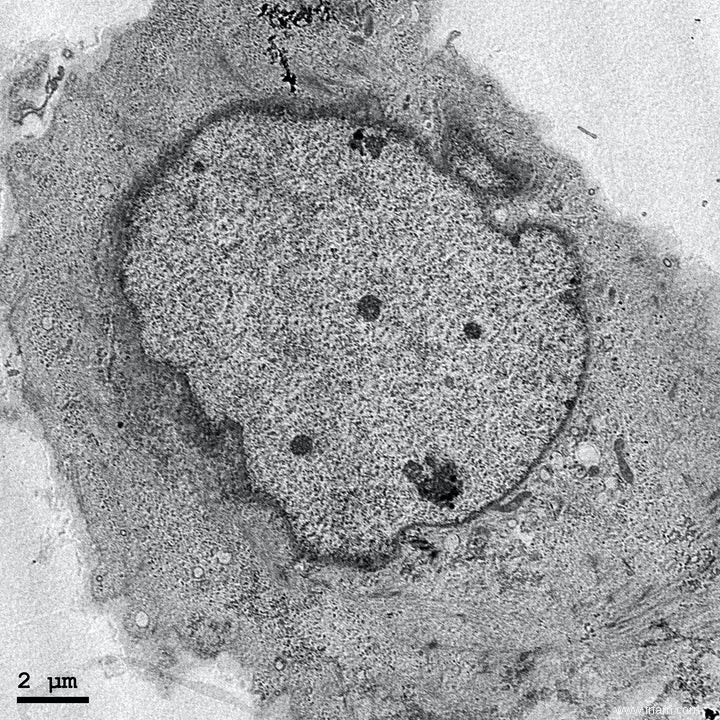 Le bouton d autodestruction de la cellule 