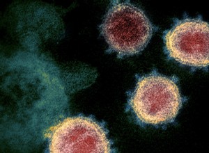 Que fait le covid-19 sur notre système nerveux ? 