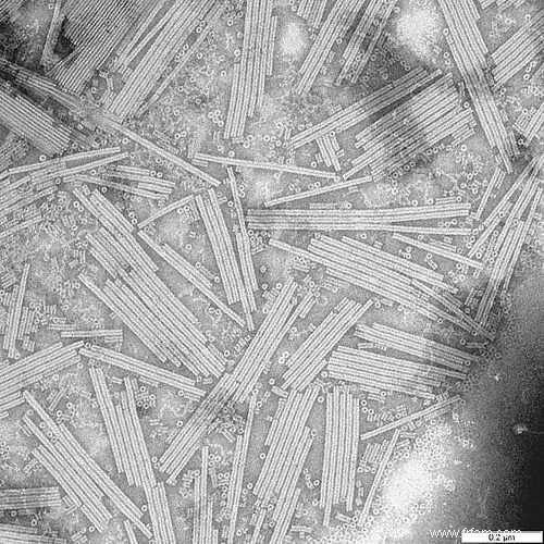 Génétique Hilde Van Esch sur l héroïne Rosalind Franklin, la découvreuse de l ADN 