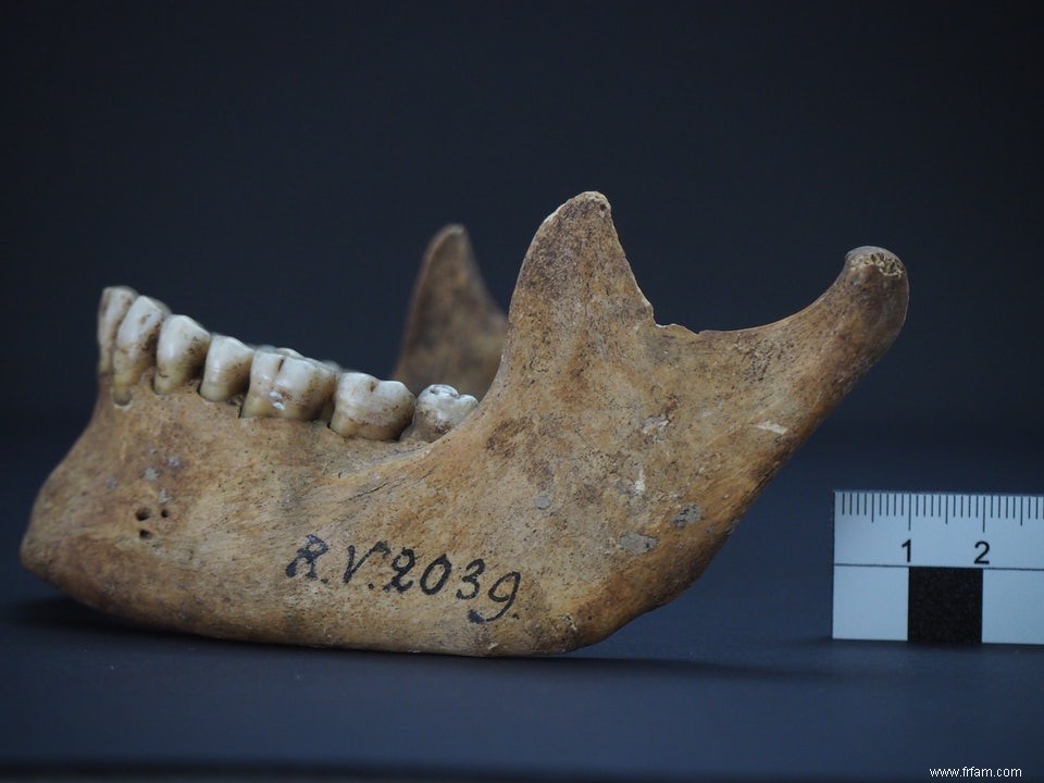 La bactérie de la peste est plus ancienne que prévu 