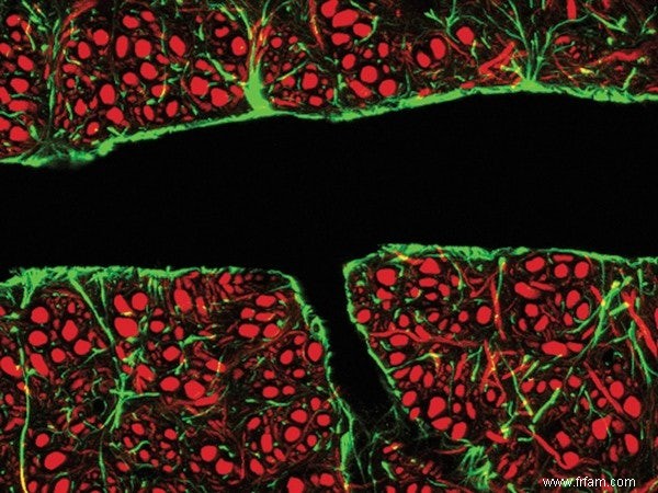 L échographie pour Alzheimer 