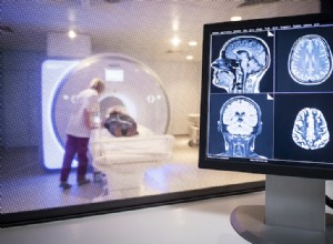 Pas de différence entre les cerveaux masculins et féminins 