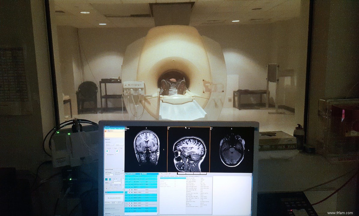 Le cerveau d un aveugle aiguise d autres sens 