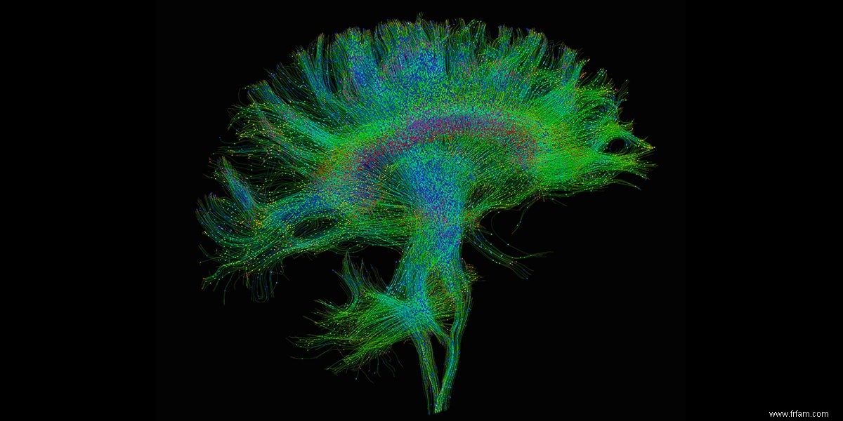 Le cerveau ne sélectionne que les cellules cérébrales les plus talentueuses 