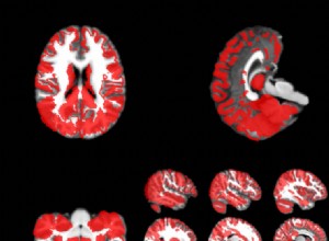 Esprit critique vs non-sens :1 - 0 