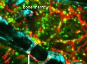 Les cellules immunitaires atteignent le cerveau par de petits tunnels dans notre crâne 