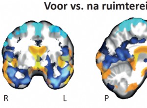 Regarder le cerveau extraterrestre 
