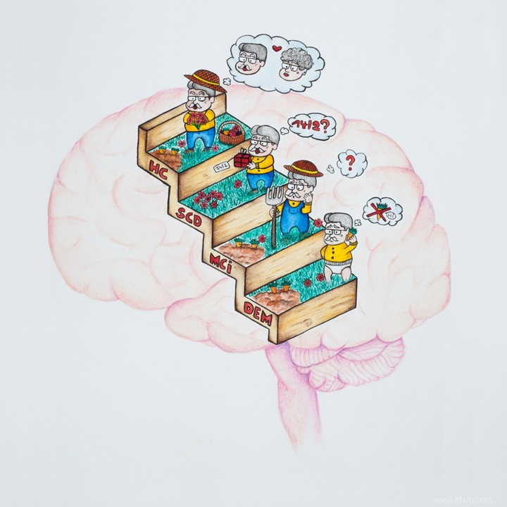 Un test simple détecte mieux la maladie d Alzheimer 