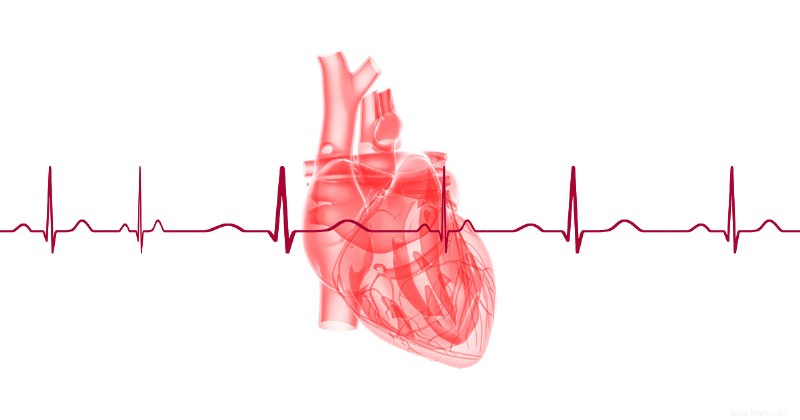 Prendre soin des patients atteints de troubles du rythme cardiaque :ce que vous devez savoir 